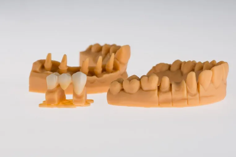 Bild: 3D-Druck für alle-Planung, Modelle und Bohrschablonen von Implant Solutions, Bingen