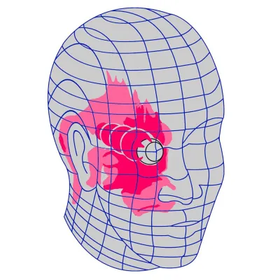 Clusterkopfschmerz Patientenabend in München Bild: Clusterkopfschmerz Patientenabend in München