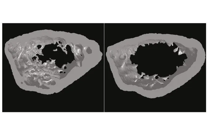 Bild: Osteoporose: neue Teile im großen Puzzle