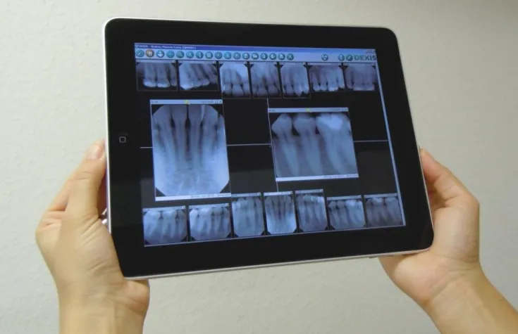 Bild: Röntgenbilder vom DEXIS® Platinum Sensor drahtlos auf das Apple iPad® übertragen