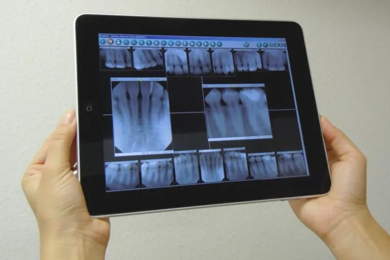 Bild: Röntgenbilder vom DEXIS® Platinum Sensor drahtlos auf das Apple iPad® übertragen