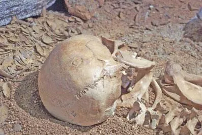 Bild: Transplantationsmedizin vor 4000 Jahren