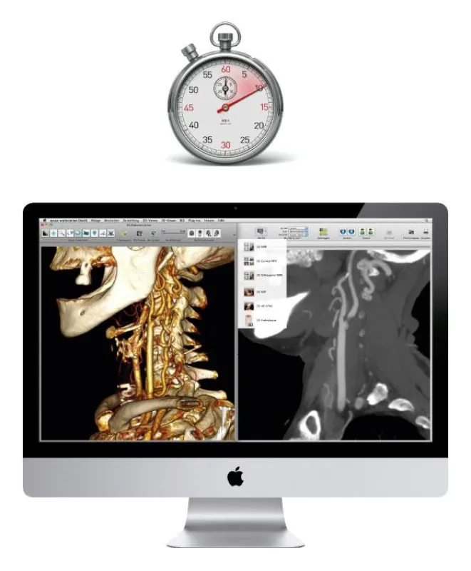 aycan workstation OsiriX PRO beim Face-Off
