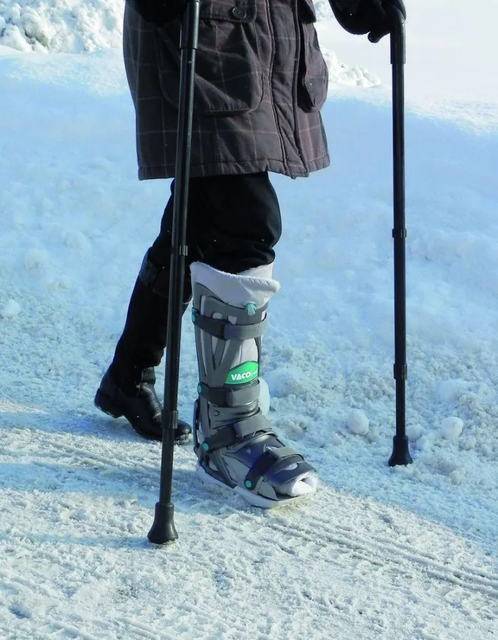 Gipsbein ade: Nach einem Beinbruch gibt es heute meist eine moderne und leichte Vakuumschiene (Bild: OPED GmbH)