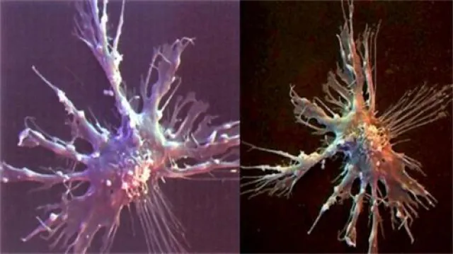 Bild: Diagnose Krebs! Eine ganzheitliche Betrachtung