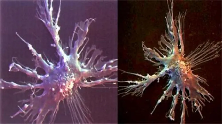 Bild: Diagnose Krebs! Eine ganzheitliche Betrachtung