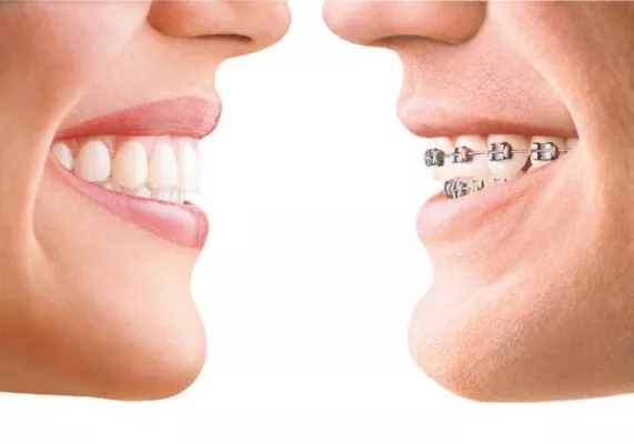 Bild: Invisalign® komplettiert Behandlungsspektrum der Praxisklinik der Zahnheilkunde am Luisenhospital in Aachen
