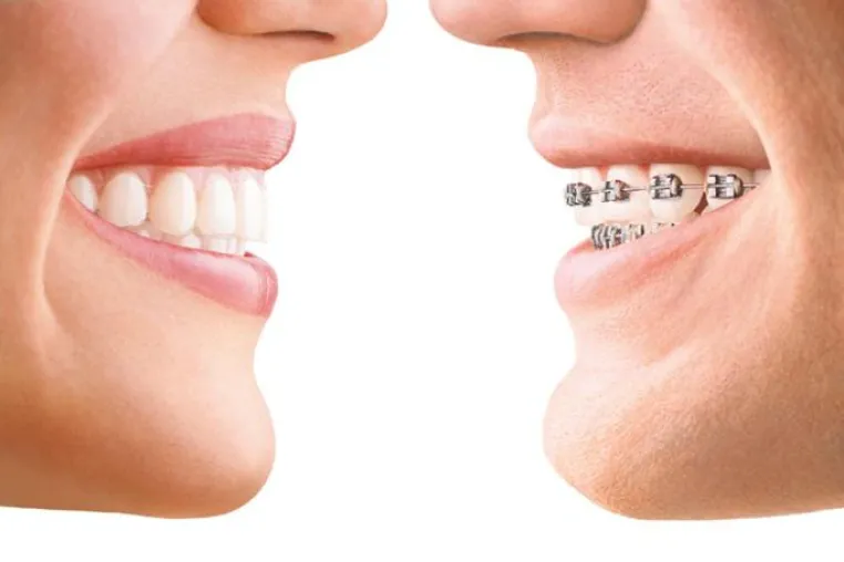 Bild: Invisalign® komplettiert Behandlungsspektrum der Praxisklinik der Zahnheilkunde am Luisenhospital in Aachen
