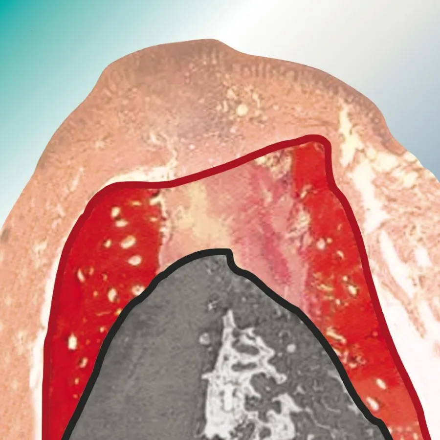 Das Therapiekonzept „Regeneration“ der bredent group