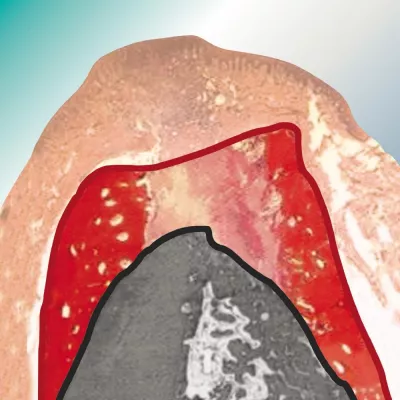Bild: Zahnpraxis und Zahntechniklabor: „Regeneration“ neues Therapiekonzept der bredent group