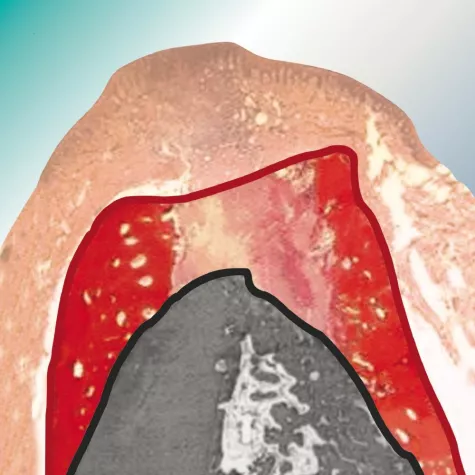 Bild: Zahnpraxis und Zahntechniklabor: „Regeneration“ neues Therapiekonzept der bredent group