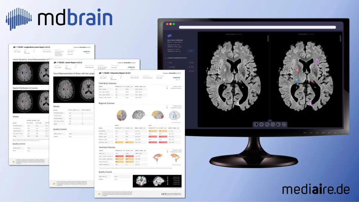 KI-basierte Bildanalyse und strukturierte Befundung