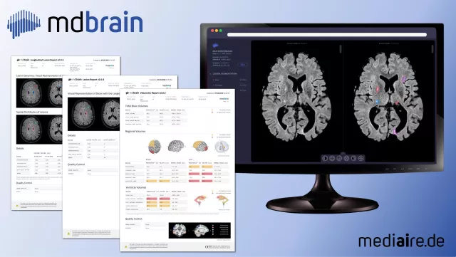 mediaire & Smart Reporting gehen Kooperation zur Optimierung KI-gestützter diagnostischer Workflows ein Bild: mediaire & Smart Reporting gehen Kooperation zur Optimierung KI-gestützter diagnostischer Workflows ein