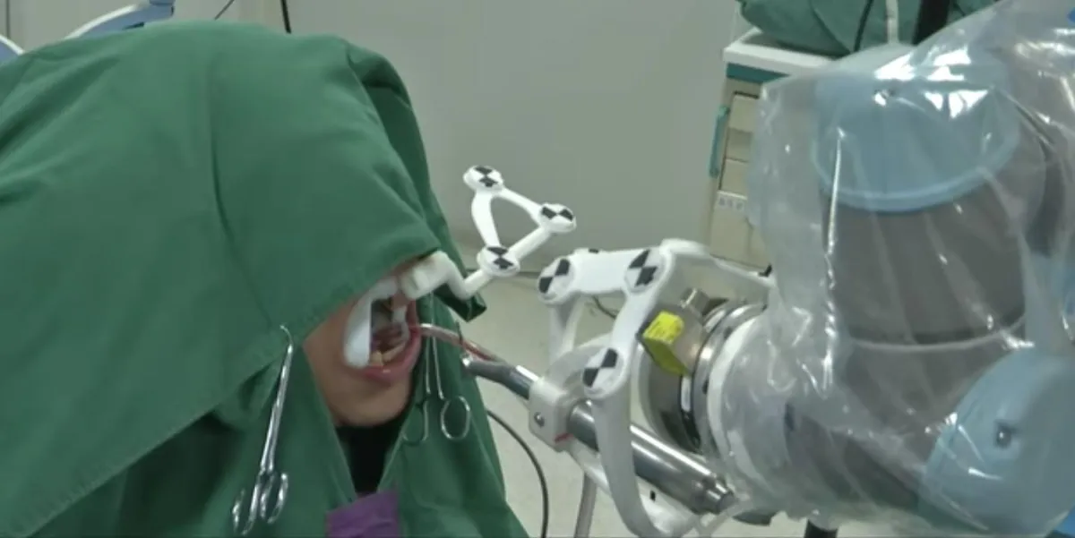 Cobot als Zahnarzt reduziert die Kosten der Behandlung