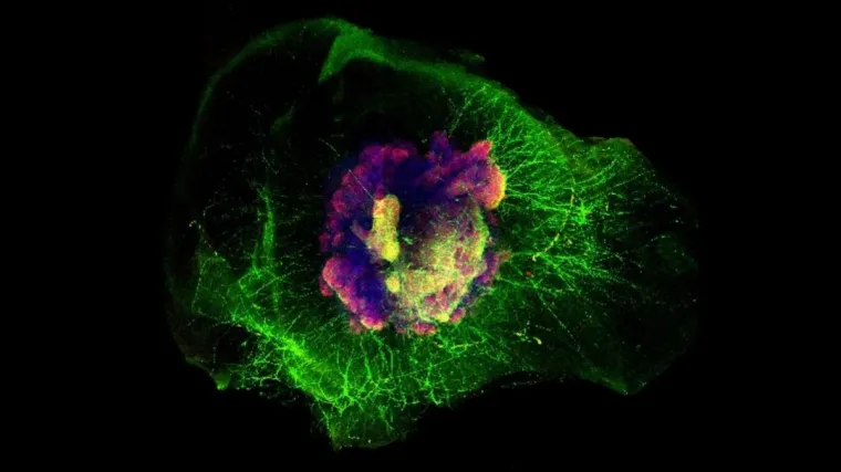 Bild: Jens Schwamborns 3D-Mini-Gehirne helfen im Kampf gegen das Corona-Virus
