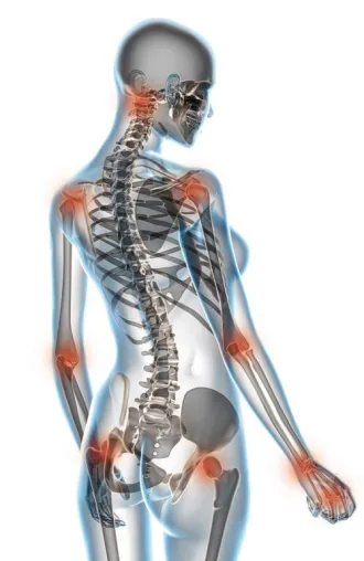 Bild: Vortrag zum Thema Arthrose im Therapie- und Trainingszentrum Baumann in Poing bei München