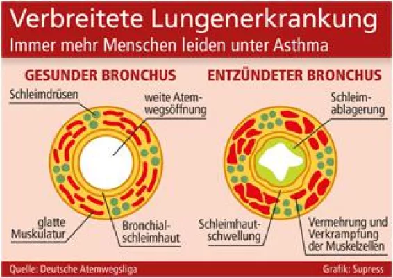 Bild: Verbreitete Lungenerkrankung