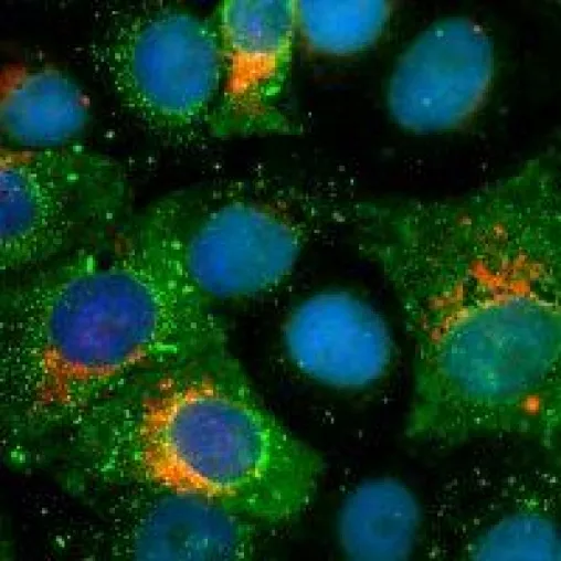 NanoTag Biotechnologies gibt SARS-CoV-2 Nano-Antikörper aus Alpakas den letzten Schliff Bild: NanoTag Biotechnologies gibt SARS-CoV-2 Nano-Antikörper aus Alpakas den letzten Schliff
