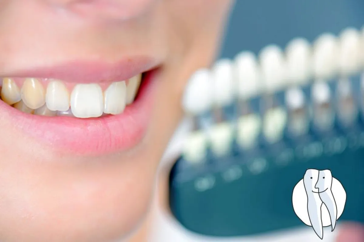 Gelber Zahn trotz Putzens  fotolia©auremar