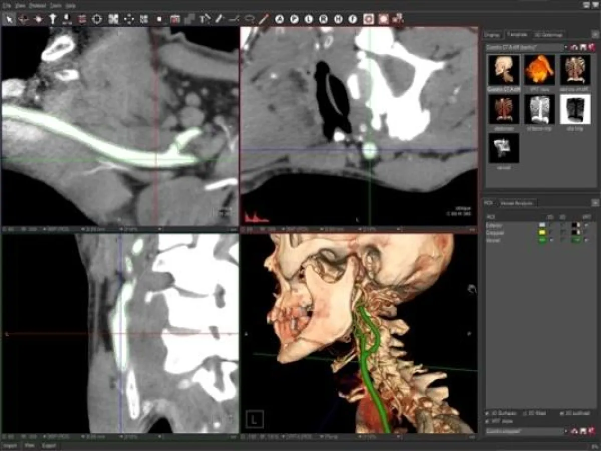 Webbasierte PACS in 3D Thin Clients Technologie erfüllt alle Bedürfnisse der modernen Radiologie in Visualisation und Navigation.