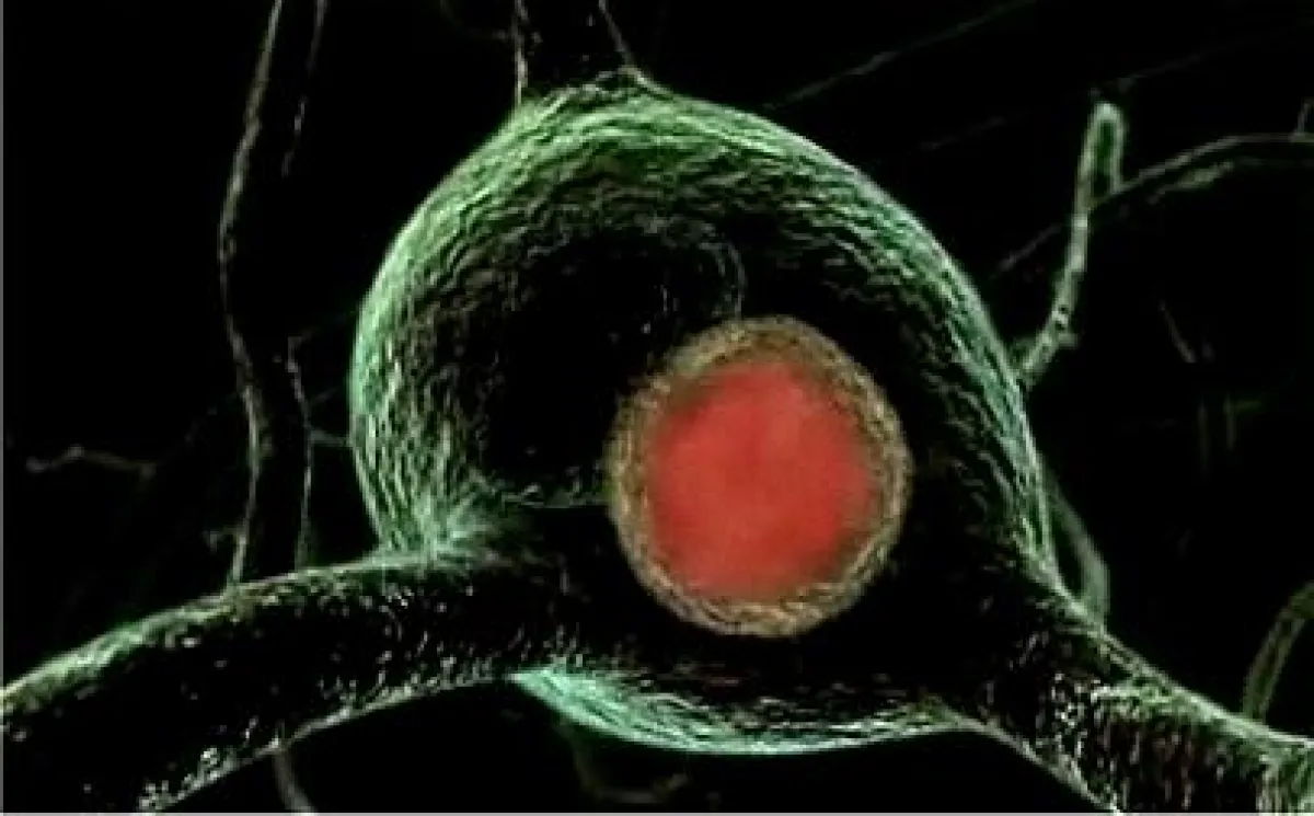 Wirkmechanismen Parkinson