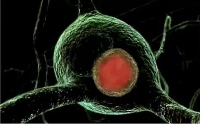 Bild: Neues aus der Medizin-Zuschauer voten Thema „Parkinson“