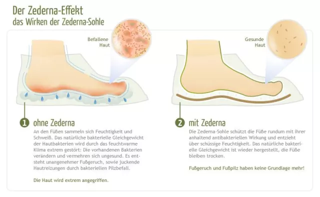 Die Zederna-Einlegesohle jetzt neu für Kinder Bild: Die Zederna-Einlegesohle jetzt neu für Kinder