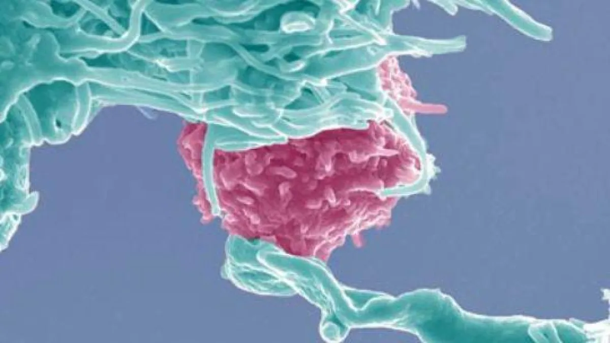 Krebszellen können mit dendritischen Zellen sichtbar gemacht werden