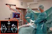 Bild: Erste Stiftungsprofessur für Navigationstechnologie in der Orthopädie und Sportmedizin in Hamburg