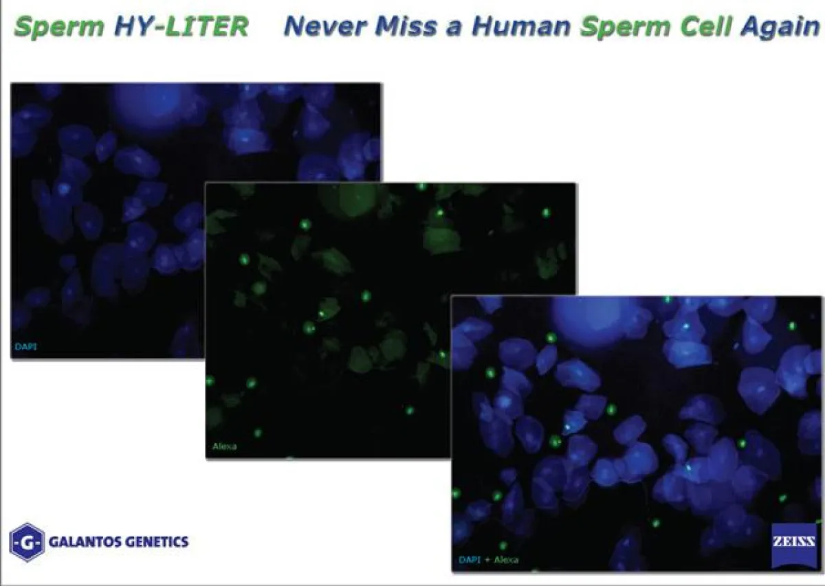 Sperm HY-LITER bringt Spermien zum Leuchten, Spermien leuchten grün zwischen allen anderen Zellen (die blau leuchten)