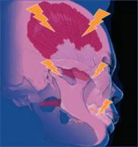 CMD aus Sicht der evidenzbasierten Zahnmedizin Bild: CMD aus Sicht der evidenzbasierten Zahnmedizin