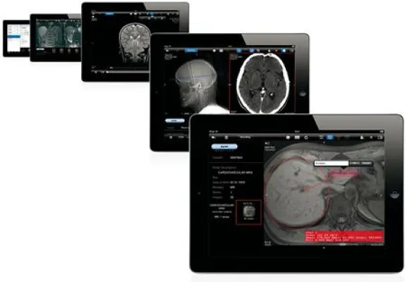 Bild: Mobiler PACS-Viewer aycan mobile mit neuer Version im Apple App Store erhältlich