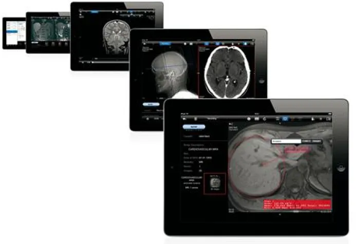 Bild: Mobiler PACS-Viewer aycan mobile mit neuer Version im Apple App Store erhältlich