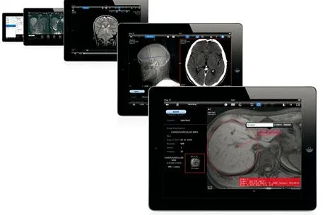 Bild: Mobiler PACS-Viewer aycan mobile mit neuer Version im Apple App Store erhältlich