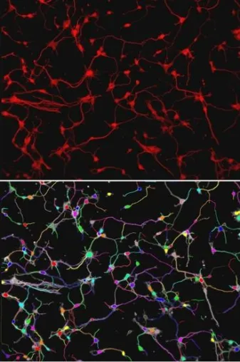 Bild: HALCON 10: Powerful Tool for Medical Image Analysis