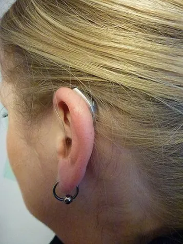 Die Kreissäge im Kopf Bild: Die Kreissäge im Kopf