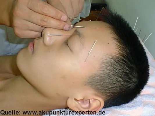Bild: Peking: Klinische Sonderfortbildung TCM / Akupunktur vom 14. bis 28.10.2010 in China