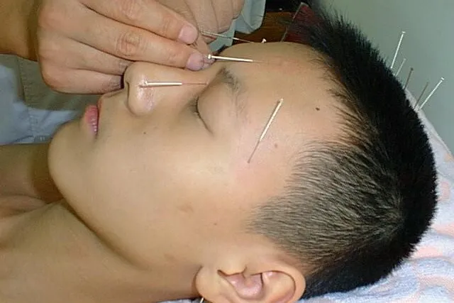 Bild: Peking: Klinische Sonderfortbildung TCM / Akupunktur vom 14. bis 28.10.2010 in China