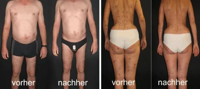 Bild: Neuer Shop mit Gesundheitswäsche für Menschen mit Hautleiden ist online und sucht Vertriebspartner