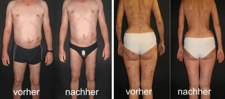 Bild: Neuer Shop mit Gesundheitswäsche für Menschen mit Hautleiden ist online und sucht Vertriebspartner