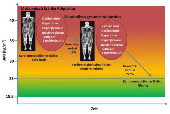 Bild: Behandlung von Übergewicht: Ist Stoffwechsel-gesunde Adipositas ein lohnendes erstes Ziel?