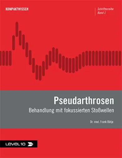Neues Praxishandbuch: Extrakorporale Stoßwellentherapie bei Pseudarthrosen Bild: Neues Praxishandbuch: Extrakorporale Stoßwellentherapie bei Pseudarthrosen