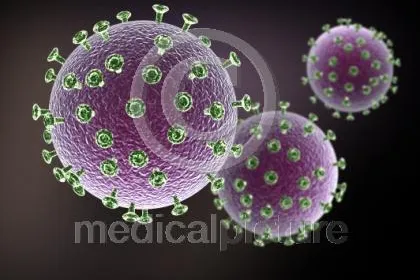 Bild: AIDS - die grenzenlose Seuche - medicalpicture Feature zum Weltaidstag am 1.12.2006