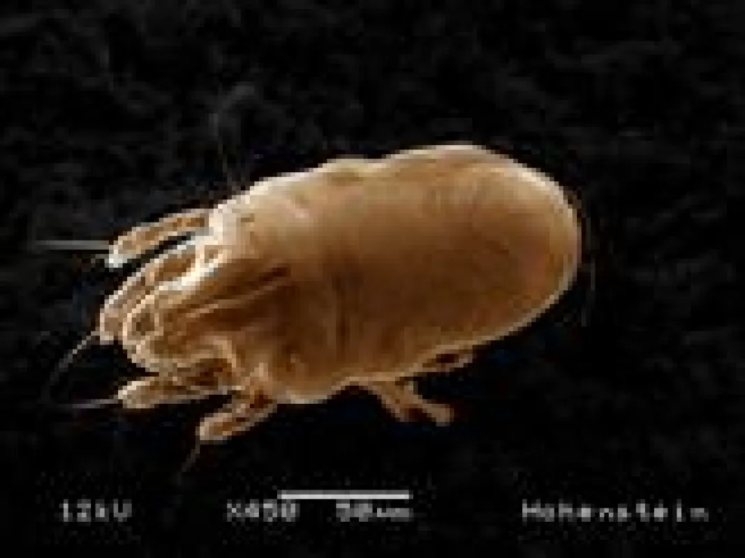 Großaufnahme einer Milbe; ©Hohenstein Institute