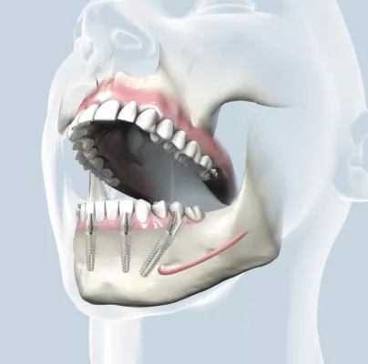 Bild: Zahnlosigkeit kein unabwendbares Schicksal