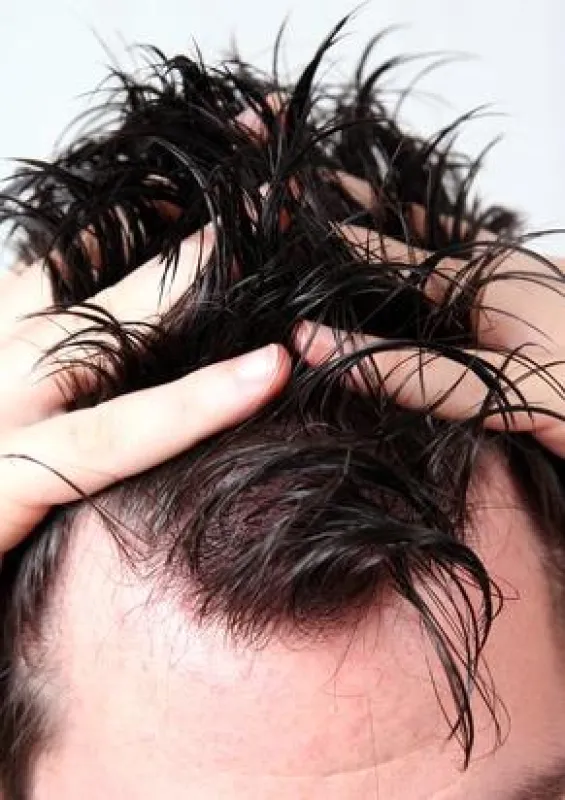 Haarausfall  muss kein Schicksal sein (Quelle: Fotolia)