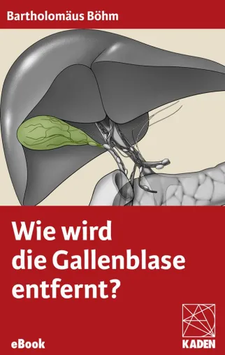 Bild: Neues eBook: Wie wird die Gallenblase entfernt?