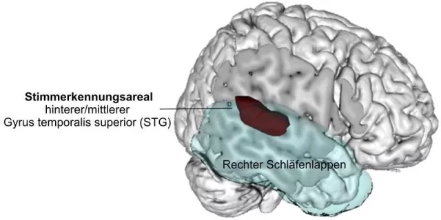 Alexa und Co in unserem Kopf: Wo die Stimmerkennung im Gehirn sitzt Bild: Alexa und Co in unserem Kopf: Wo die Stimmerkennung im Gehirn sitzt