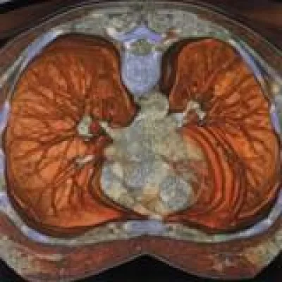 Bild: Früherkennung in der Diagnoseklinik München