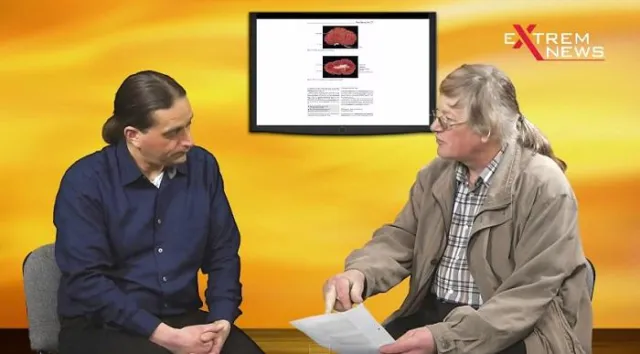 Bild: Tag der Milch: Macht 'Kuhmilch' den Menschen krank?